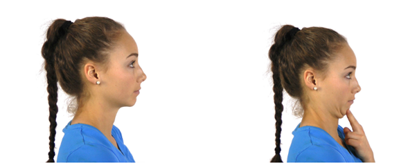 Woman with a braided ponytail demonstrating a neck exercise. Left image: neutral profile. Right image: tucking chin towards neck with fingertips touching chin. She wears a blue shirt against a white background.