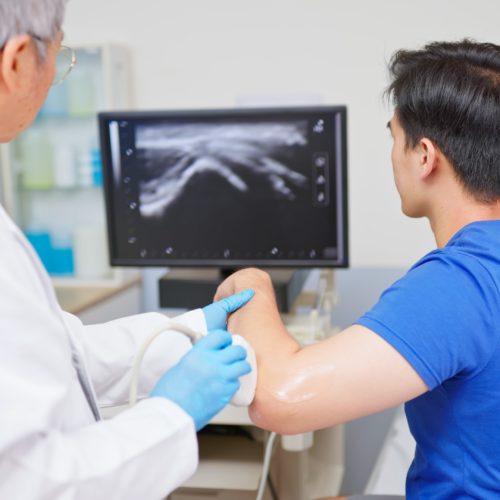 side back view asian young man undergoing ultrasound for elbow pain from sports accident sit in medical examination room